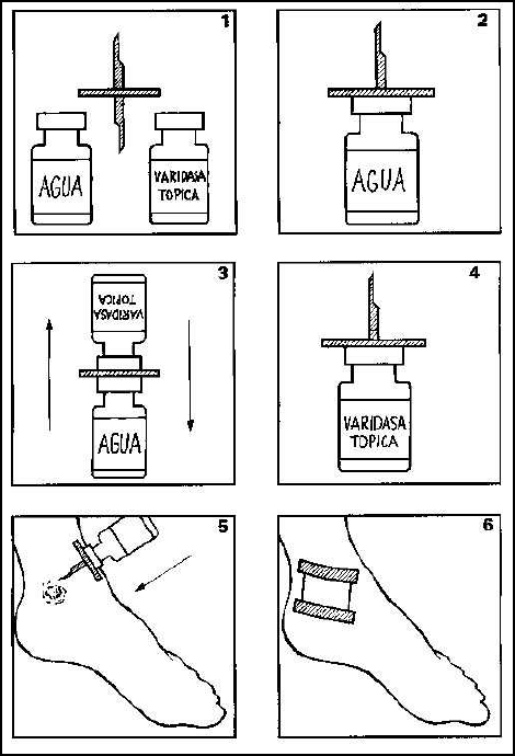 Varidasa topica-figura1 Varidasa topica-figura1